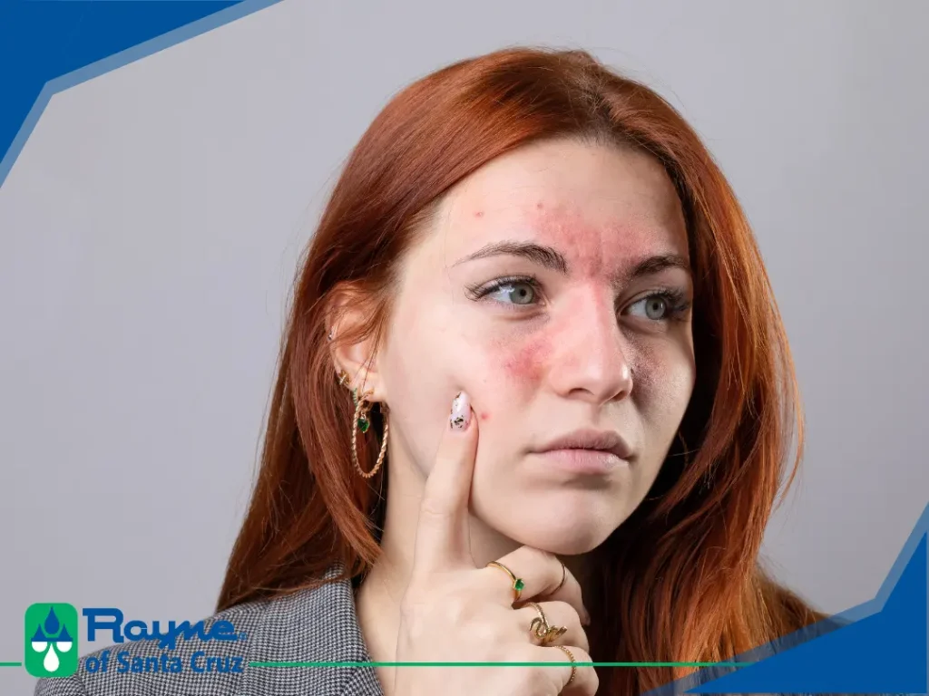 Hard Water and Sensitive Skin